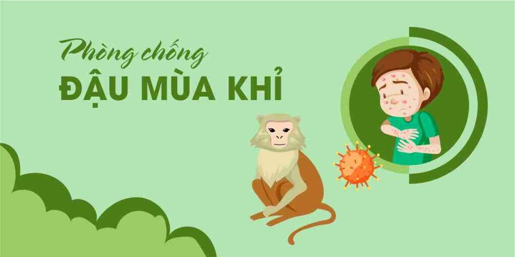 Bộ y tế cảnh báo biểu hiện và cách phòng tránh bệnh đậu mùa khỉ