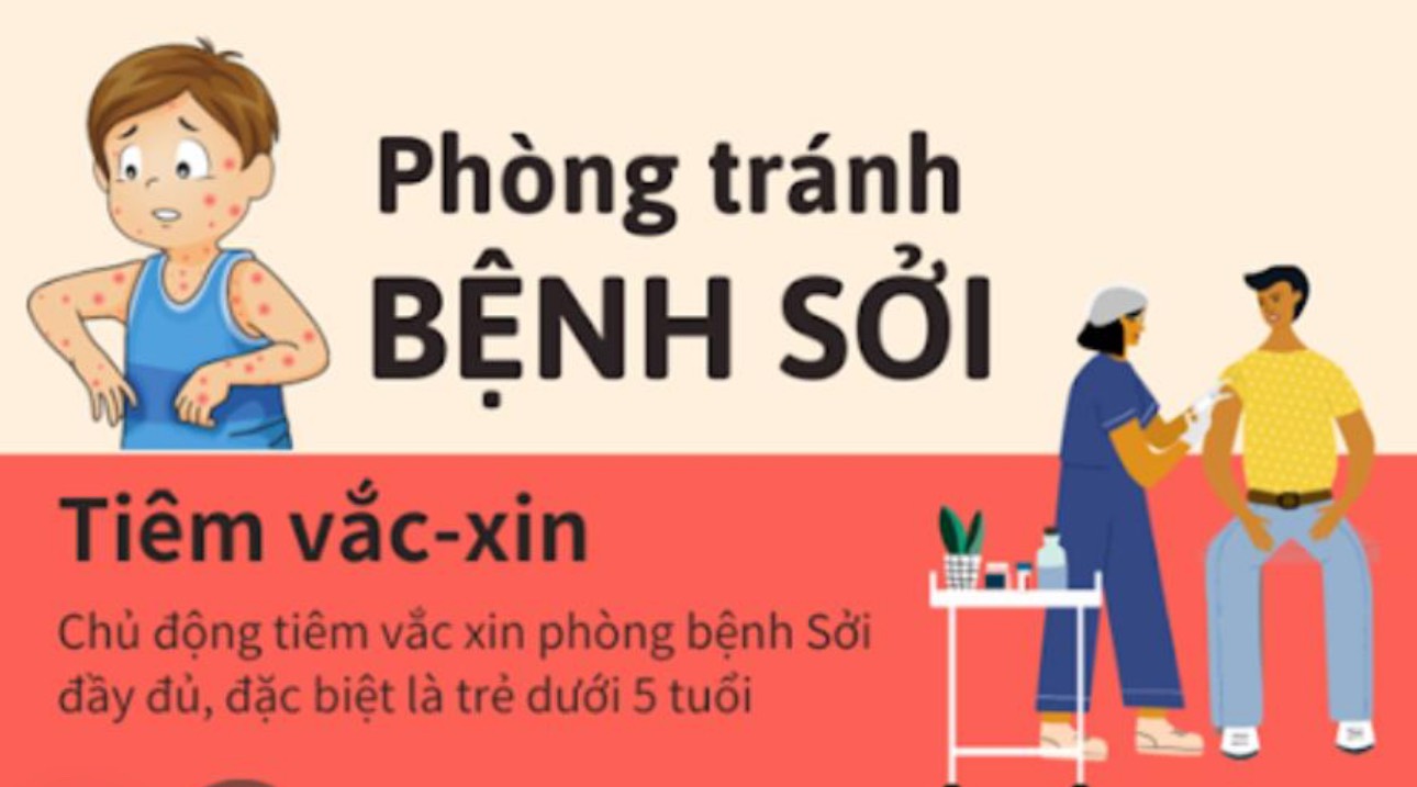 Cách phòng bệnh sởi cho trẻ em và người lớn hiệu quả người dân cần biết